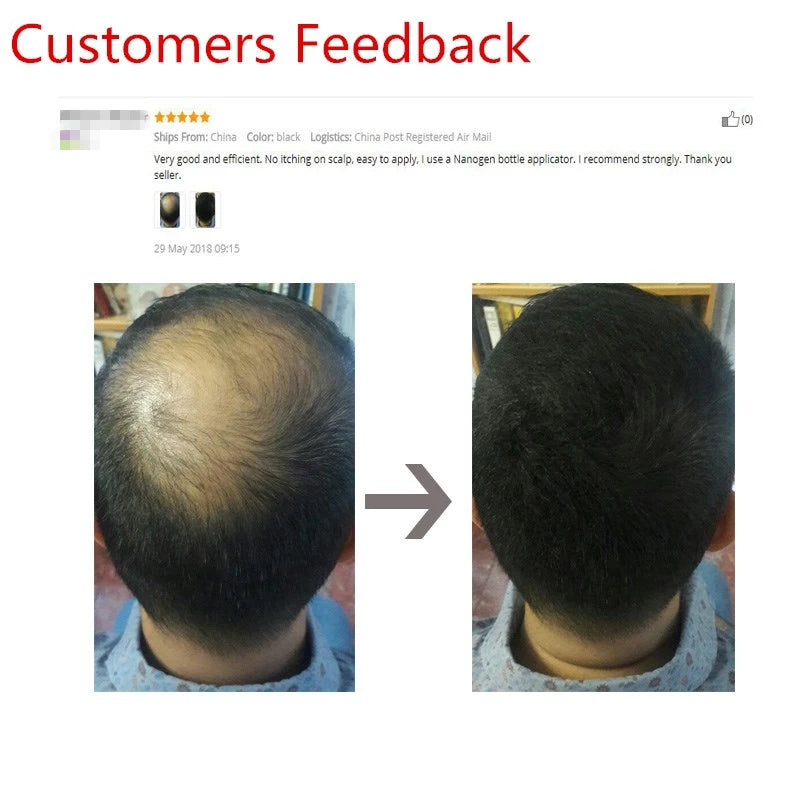 25g Keratin Hair Fibers Thickening Spray – Instant Hair Building Powder