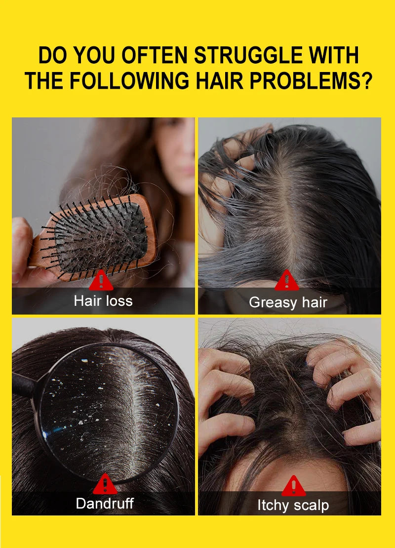Rosemary & Ginger Hair Growth Mask – Anti Hair Loss