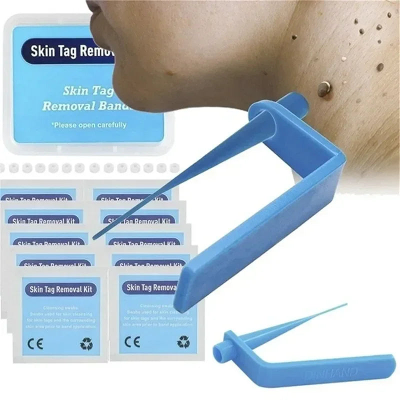 Skin Tag Remover Kit – Rubber Band Mole & Wart Removal Tool