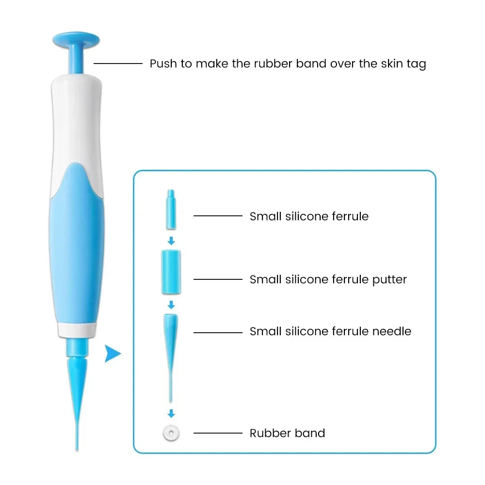Skin Tag & Wart Remover Device Kit – 2-in-1 Auto Micro