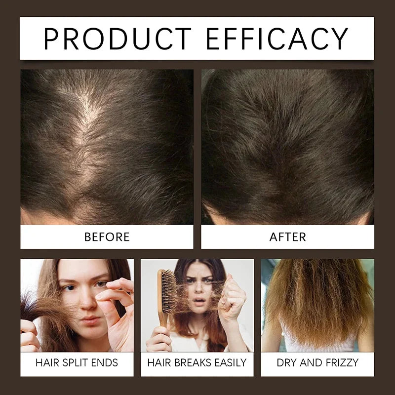 Biotin Fast Hair Growth Spray 30ml – Anti-Hair Loss & Baldness Treatment