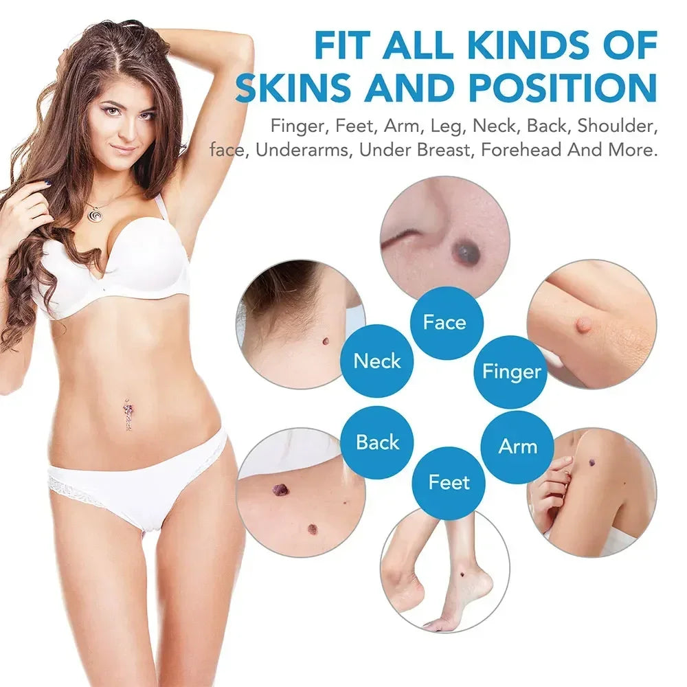 Skin Tag & Wart Remover Device Kit – 2-in-1 Auto Micro