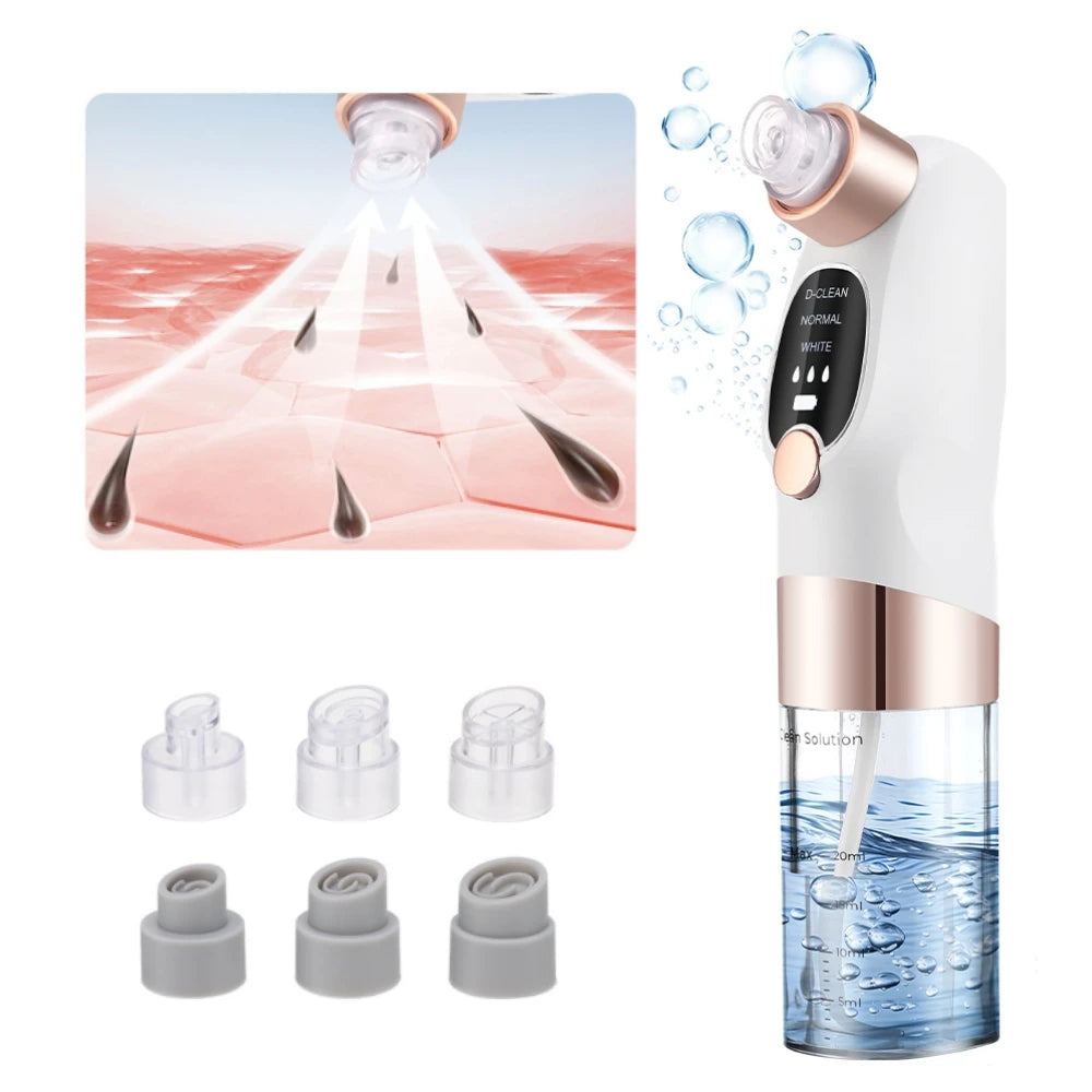 Small Bubble Blackhead Remover Pore Vacuum – 6 Suction Heads