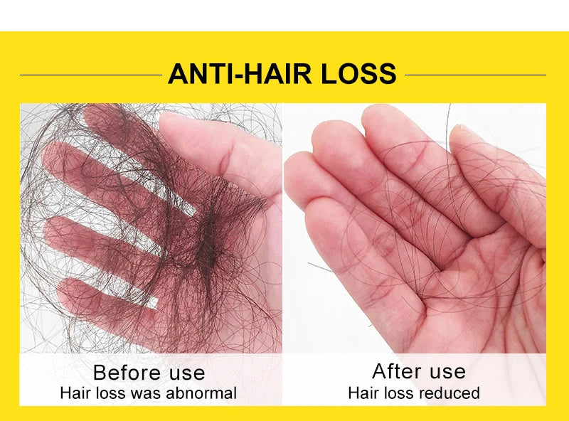 Rosemary & Ginger Hair Growth Mask – Anti Hair Loss
