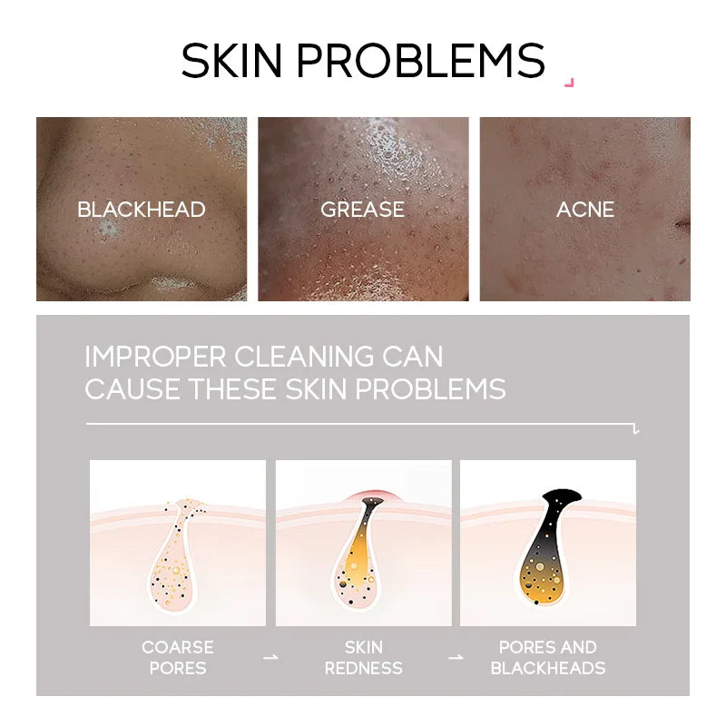 Sakura 24K Gold Blackhead Peel-Off Face Mask 50g – Deep Cleansing