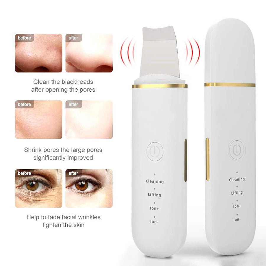 Ultrasonic Skin Scrubber – Deep Pore & Blackhead Cleansing Device