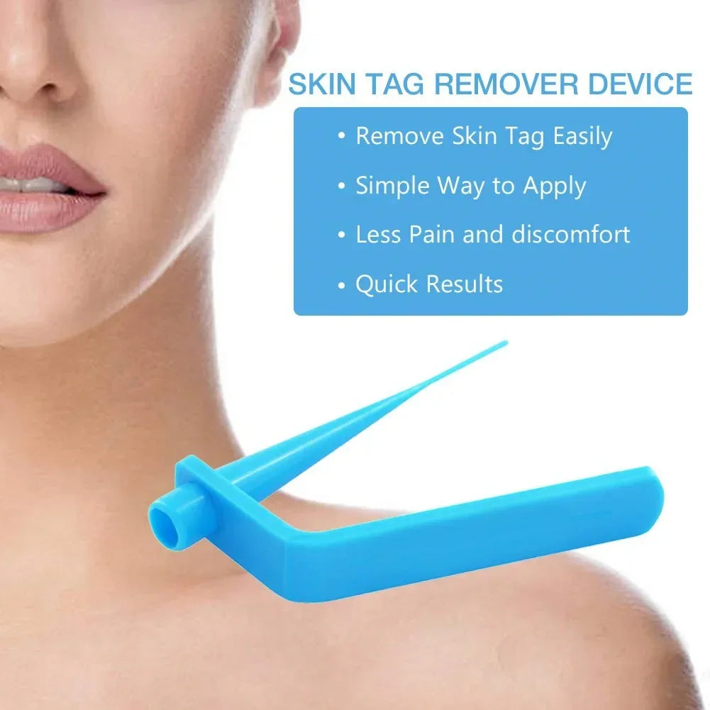 Skin Tag Remover Kit – Rubber Band Mole & Wart Removal Tool