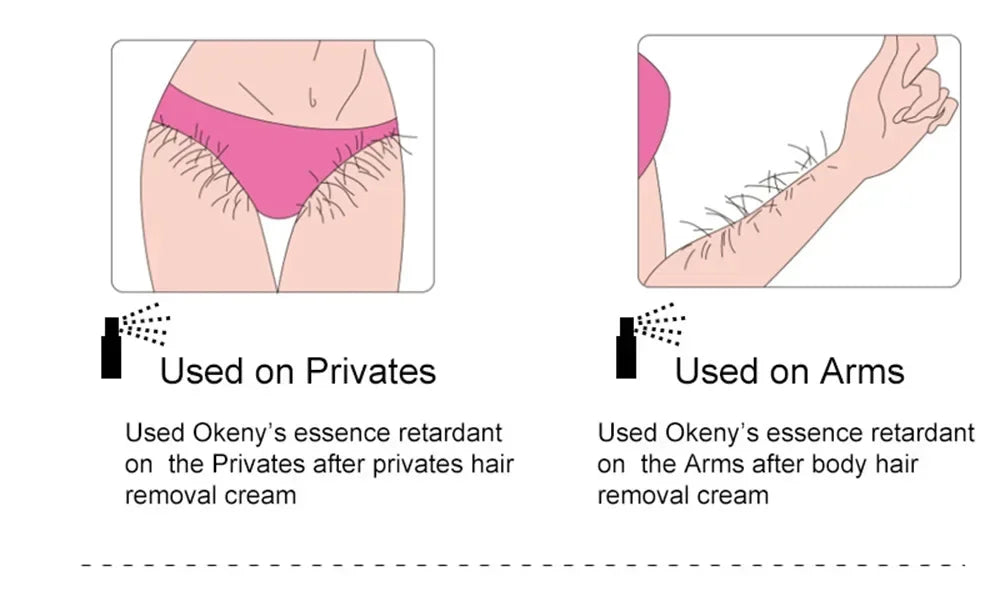 2-Minute Fast Hair Removal Spray – Painless Depilatory for Men & Women