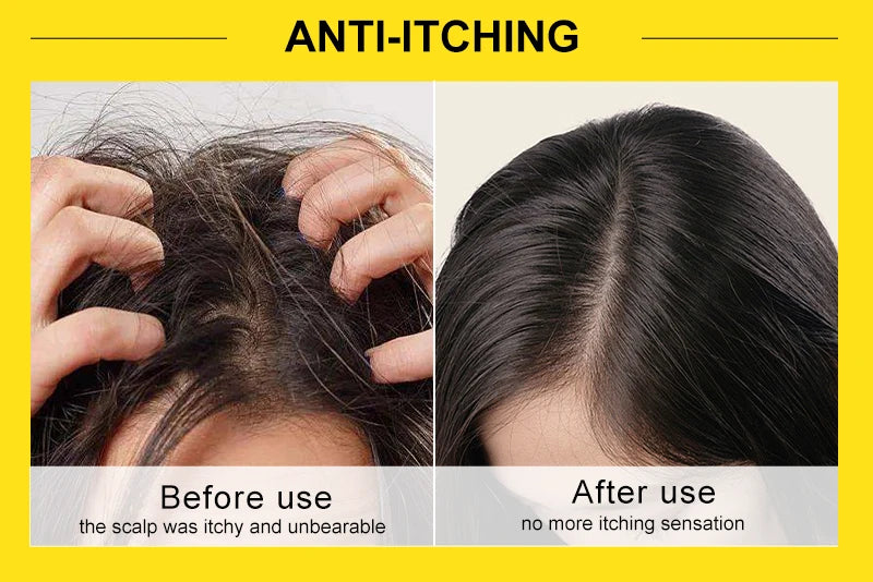 Rosemary & Ginger Hair Growth Mask – Anti Hair Loss