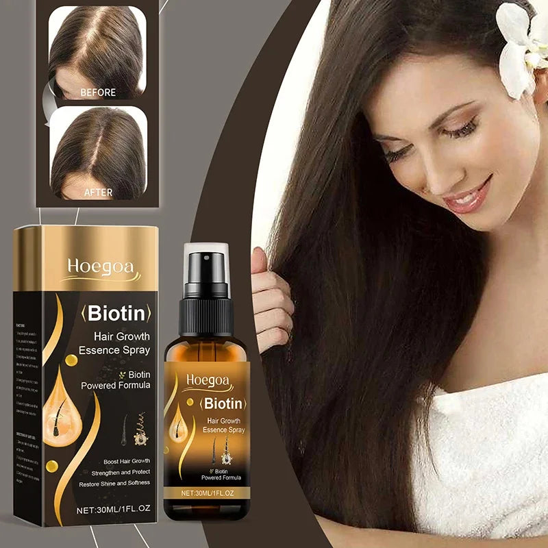 Biotin Fast Hair Growth Spray 30ml – Anti-Hair Loss & Baldness Treatment
