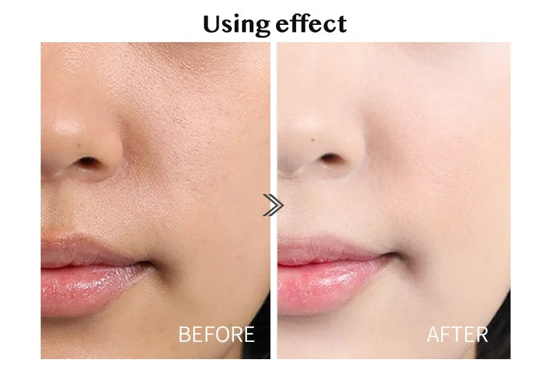 Hyaluronic Acid Ampoule Facial Serum – Pore Shrinking & Whitening