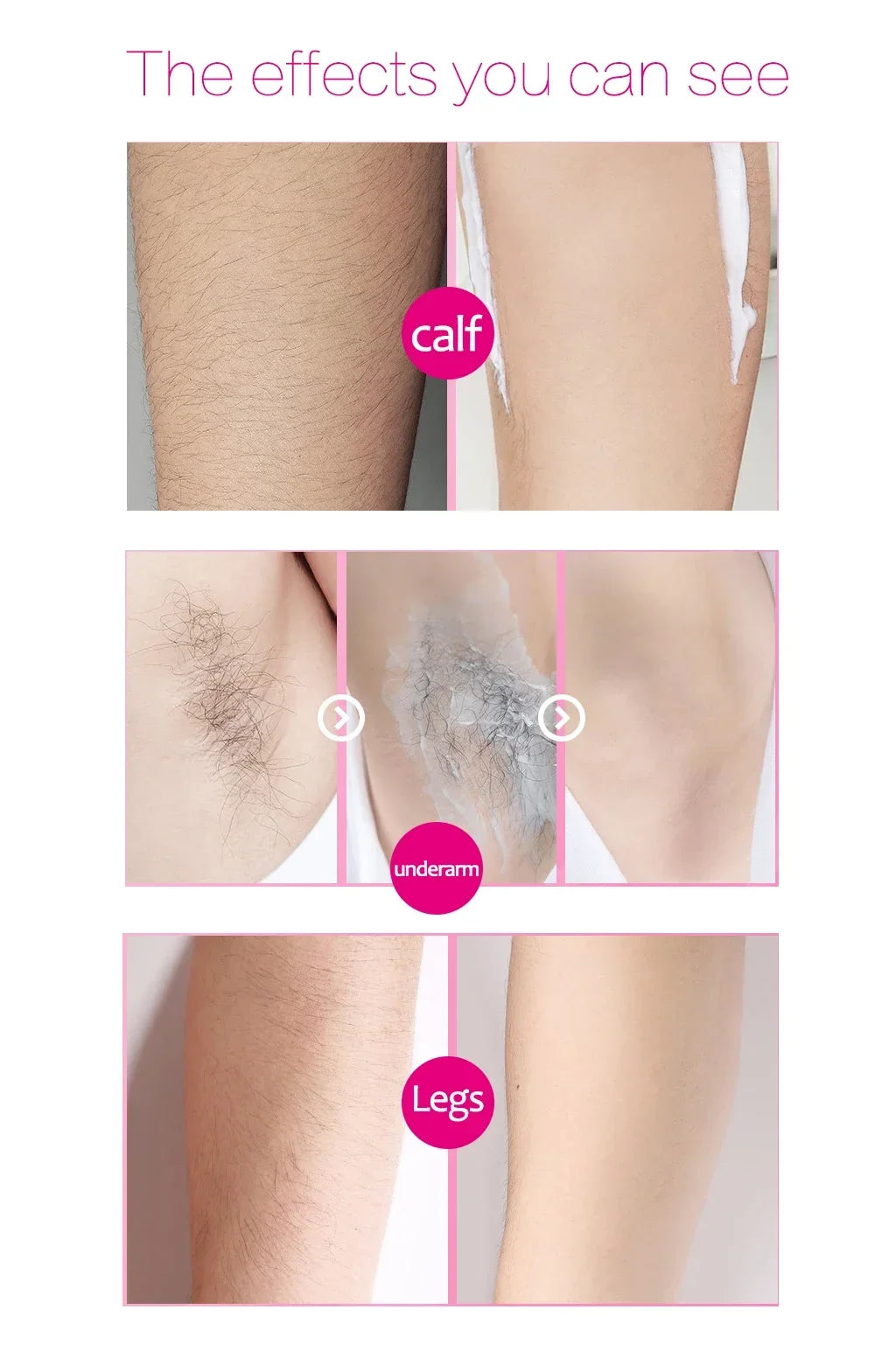 2-Minute Fast Hair Removal Spray – Painless Depilatory for Men & Women