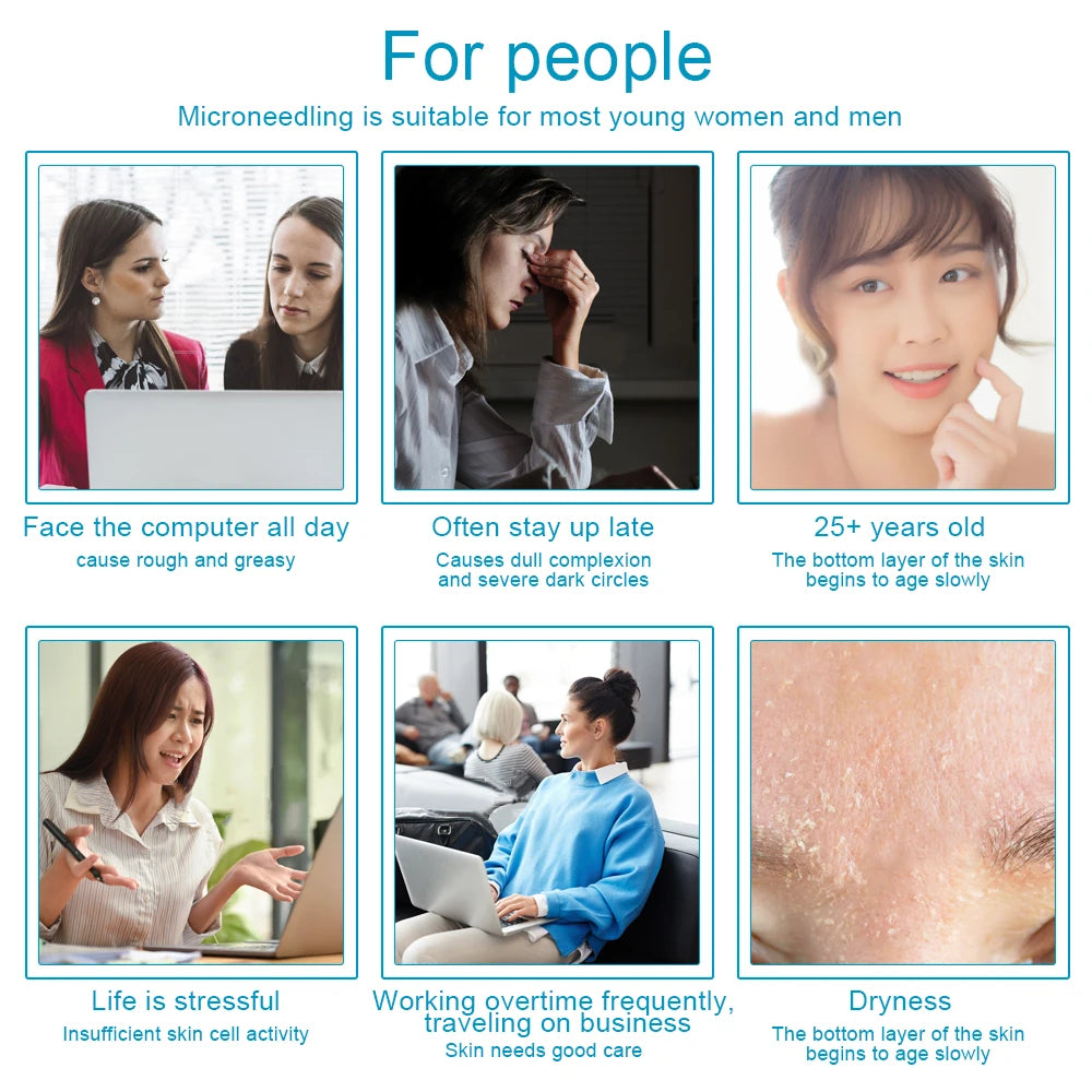 540-Needle Derma Roller – Face, Body, Hair & Beard Growth (0.2–0.3mm)