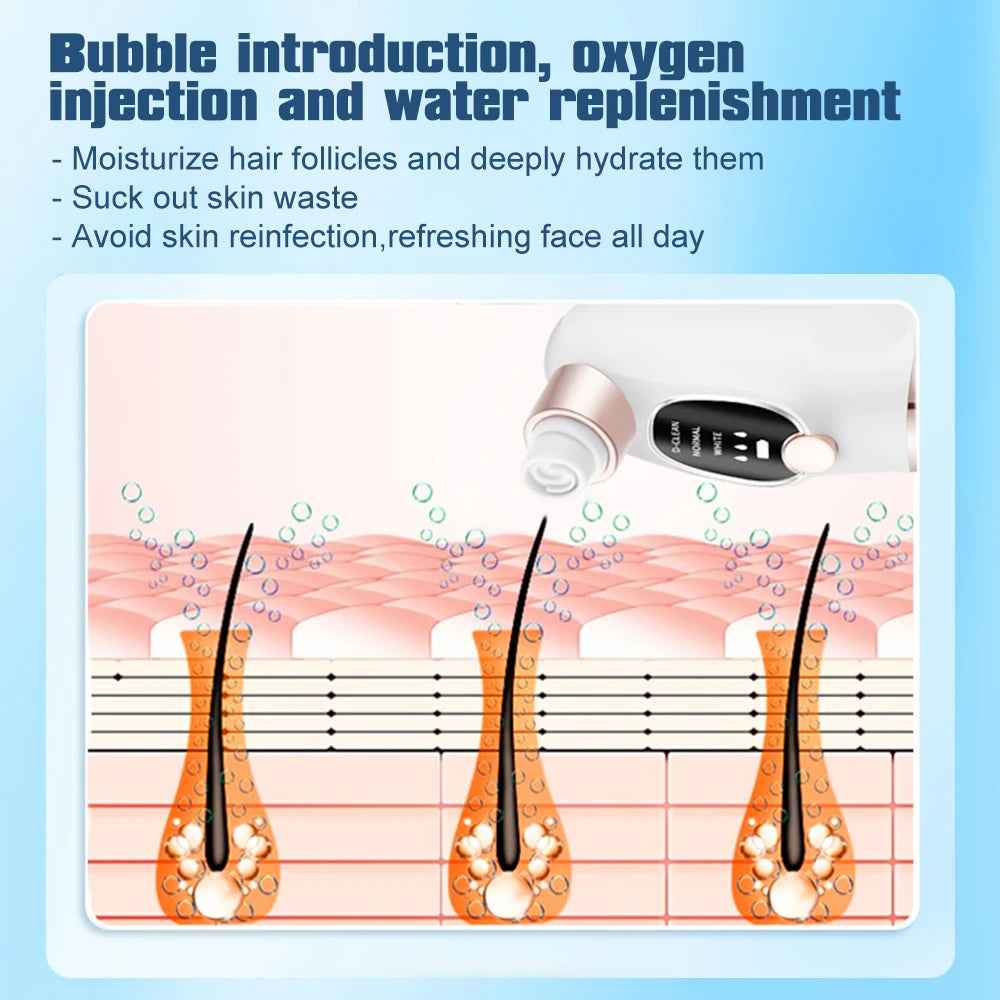 Small Bubble Blackhead Remover Pore Vacuum – 6 Suction Heads
