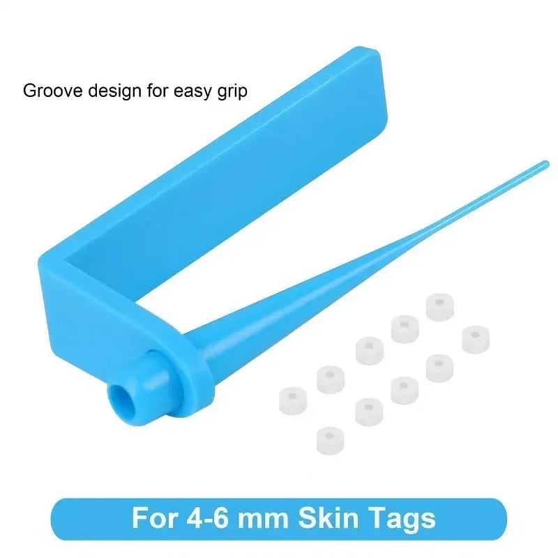 Skin Tag Remover Kit – Rubber Band Mole & Wart Removal Tool