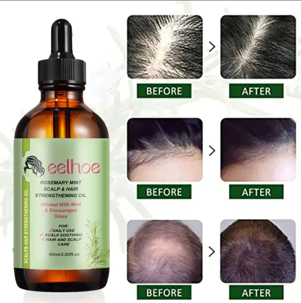 Rosemary & Mint Hair Growth Essential Oil – Nourishing Strengthening Treatment