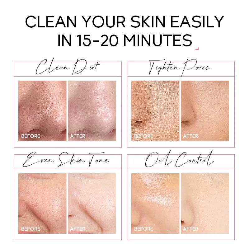 Sakura 24K Gold Blackhead Peel-Off Face Mask 50g – Deep Cleansing