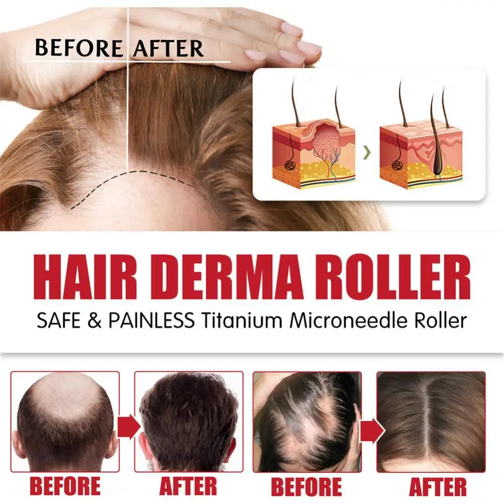 540 Titanium Micro Needle Derma Roller 0.25mm – Skin Rejuvenation & Hair Growth