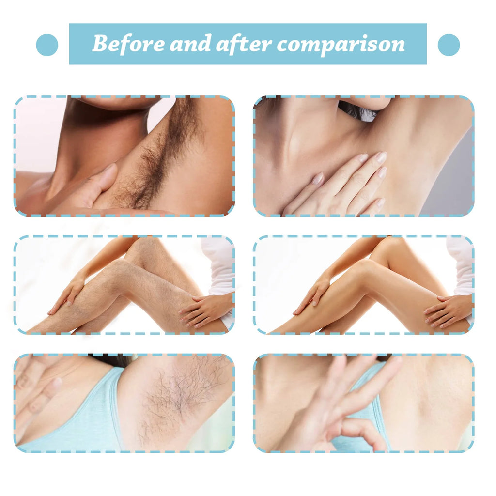 Permanent Hair Removal Spray – Natural Hair Growth Inhibitor 20ml