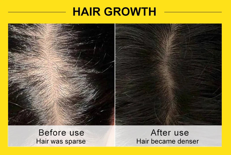 Rosemary & Ginger Hair Growth Mask – Anti Hair Loss