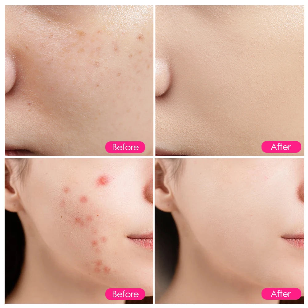 LED Red Light Photon Therapy Face Mask – Anti-Aging & Acne