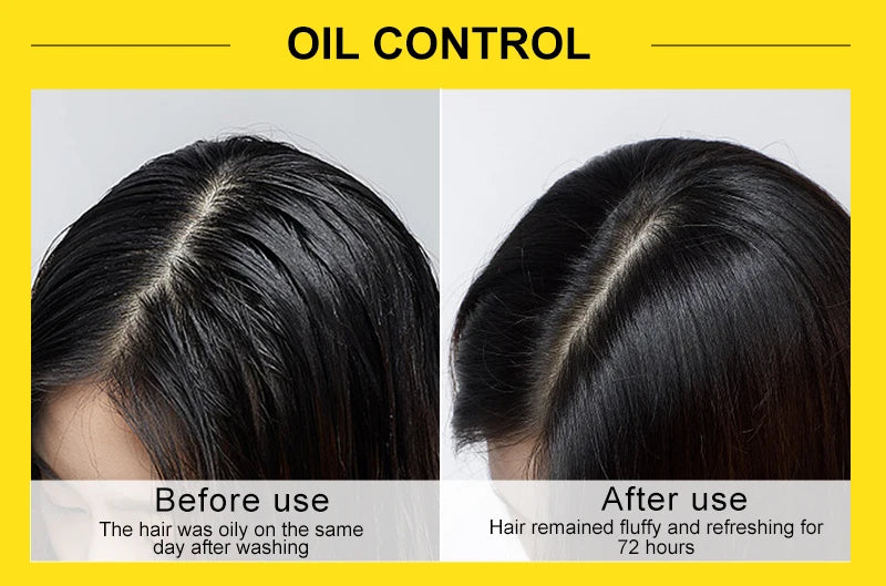 Rosemary & Ginger Hair Growth Mask – Anti Hair Loss