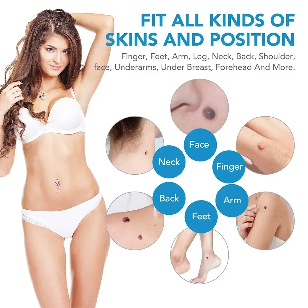 Skin Tag & Wart Remover Device Kit – 2-in-1 Auto Micro