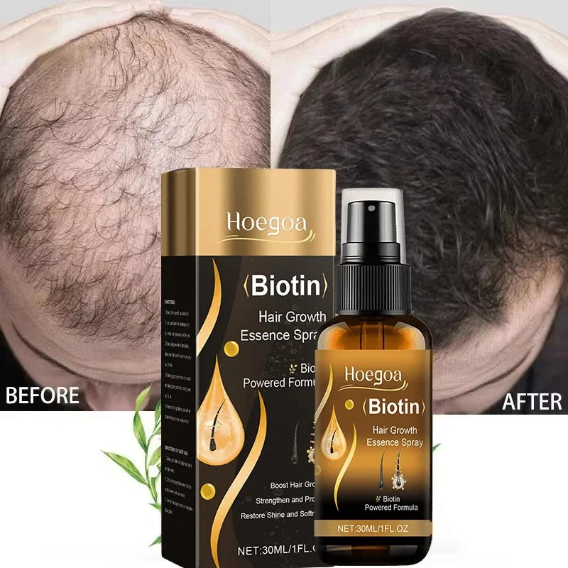 Biotin Fast Hair Growth Spray 30ml – Anti-Hair Loss & Baldness Treatment