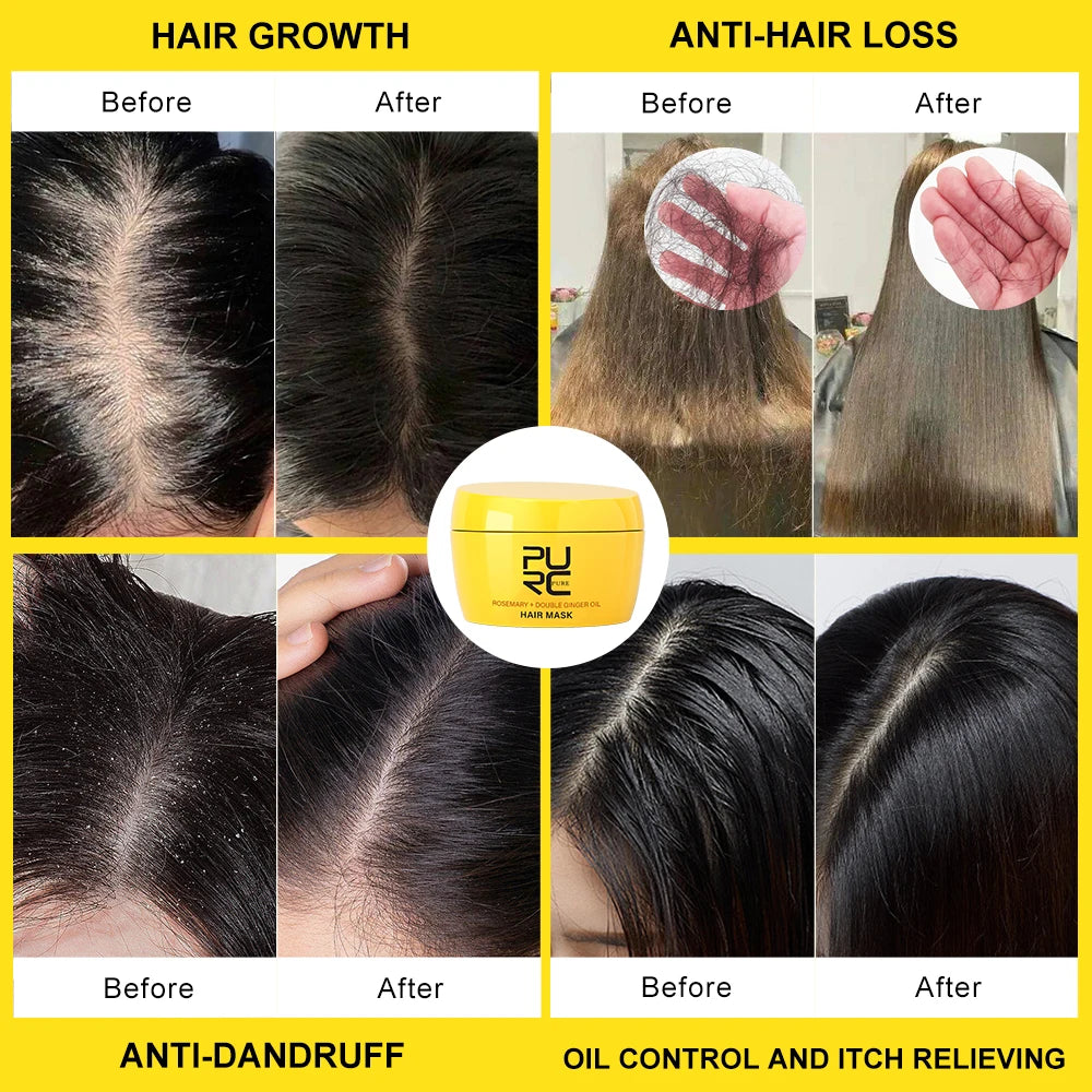 Rosemary & Ginger Hair Growth Mask – Anti Hair Loss