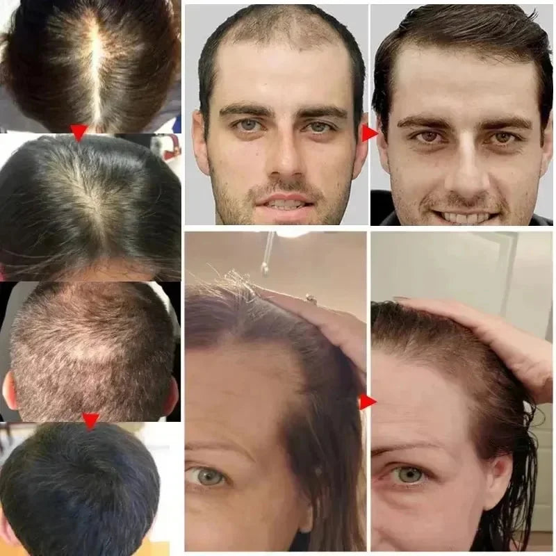 Biotin Fast Hair Growth Spray 30ml – Anti-Hair Loss & Baldness Treatment