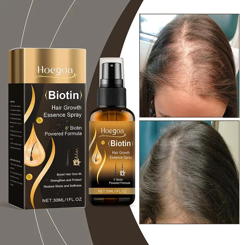 Biotin Fast Hair Growth Spray 30ml – Anti-Hair Loss & Baldness Treatment